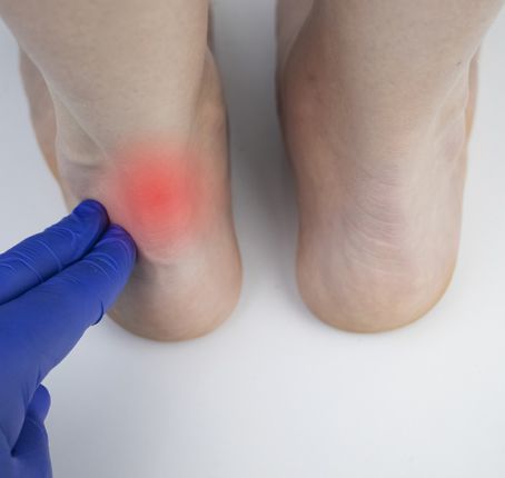 Achilles Tendinitis